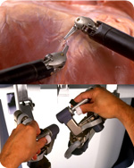 Da Vinci: chirurgia robotica urologica